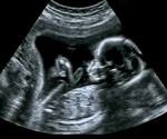 Dutch researchers to develop artificial womb prototypes