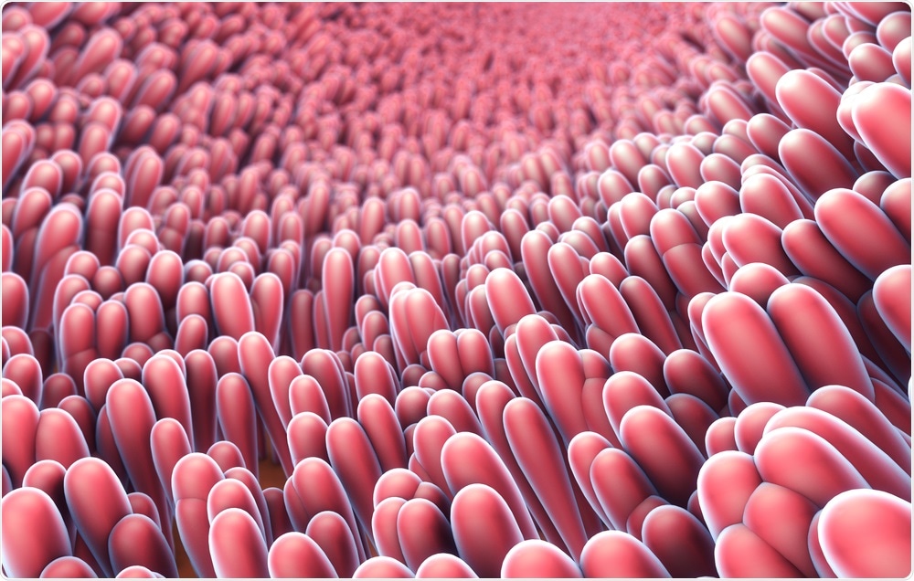 Intestine/ gut - the area affected in Crohn
