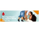 Relevance of Capillary Blood Sampling for Hemoglobin Results