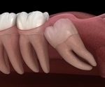 Driving Stem Cell Differentiation in Teeth using a Hardened Polymer Matrix