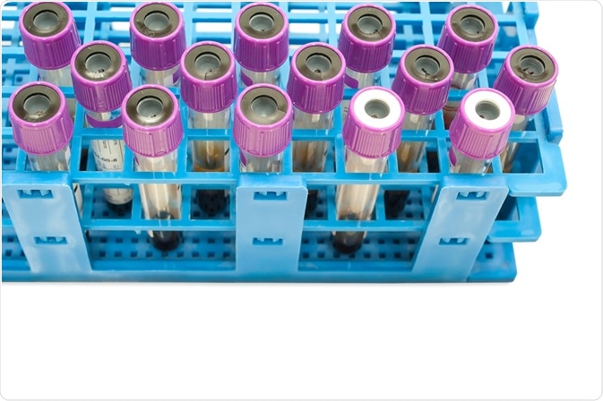 Blood test