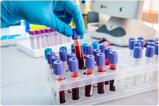 Blood test