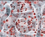 Potent antimicrobial could combat antibiotic-resistant MRSA infections