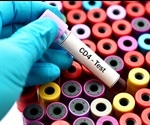 Microfluidic Imaging Flow Cytometry – Challenges and Developments