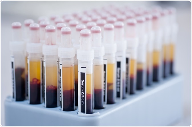 blood serum
