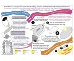 GN Corporation granted Indian patent for novel corneal cell transplantation using nano-composite gel sheet