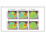 Mice study shows the impact of taking antidepressants during pregnancy
