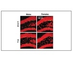 High fat diet limits birth and development of new neurons in female mice