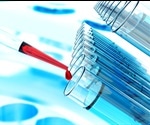 Developing software for cell and gene therapy supply chain tracking