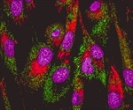 What is Epithelial-Mesenchymal Transition (EMT)?