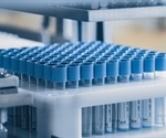 Manage Your Risk: Monitoring the Environment of Aseptic Processes