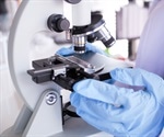 High Throughput Biophysical Screening for Development and Formulation of Biologics