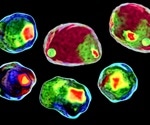 Image Cytometry Technology and Tissue Analysis