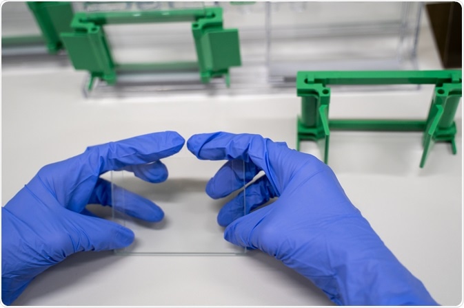 western blot