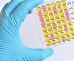 Overcoming Challenges of Assays of Complex Cellular Models with Real-Time Live-Cell Analysis