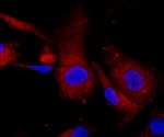 What is Immunofluorescent Array Tomography?