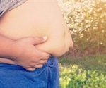 Poorest countries have high levels of both obesity and malnutrition