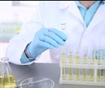 Diagnosing prostate cancer through a £225 urine test