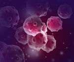 Prognosis and Outcomes for Endocrine Resistant Versus Endocrine Sensitive Patients with Metastatic Breast Cancer