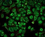 Investigating new cancer therapy candidates with live-cell imaging