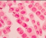 Seeing the full picture, real-time analysis of live-cells