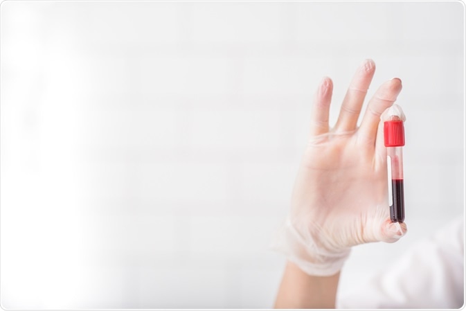 Scientist holding up sample for analysis by GC-MS