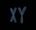 Second-ever case of semi-identical (sesquizygotic) twins