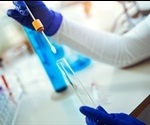 What is Microbial Forensics?