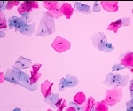 Developing a Cervical Cancer Test That’s 100% Predictive