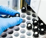 Analytical Highlight: Recent Advances in UHPLC