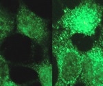 Causes of disease including infant cancer can be revealed with new tool from Princeton University research team