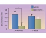 Synaptic Plasticity, Learning and Memory in the Perirhinal Cortex