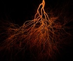 Lab-grown blood vessels provide hope for dialysis patients