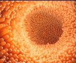 Colon cancer could be made more aggressive by common oral bacteria