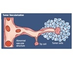 Researching Angiogenesis in Cancer