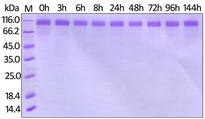 Human Her2, His Tag (Cat. No. HE2-H822R) on SDS-PAGE under reducing (R) condition. The gel was stained overnight with Coomassie Blue.