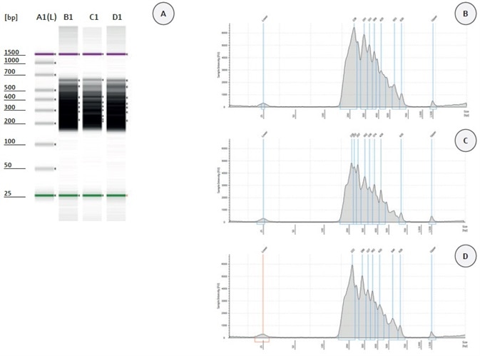 Validation of HaloPlex enrichment by 2200 TapeStation analysis. (A) Gel Image of 3 analyzed samples. Lane A1: High Sensitivity Ladder; Lane B1: patient sample 115; Lane C1: patient sample 116; Lane D1: patient sample117. Electropherograms (B–D): patient sample 115 (B), patient sample 116 (C), and patient sample 117 (D).