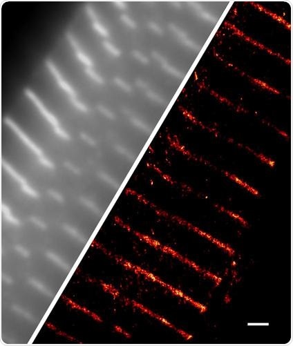 A single isolated Wistar rat cardiomyocyte stained against α-actinin. Scale bar - 1 µm