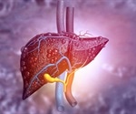 What Causes Cirrhosis?