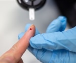 Red Blood Cell Morphology Changes in Diabetes