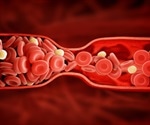 What is Fibrinolysis?
