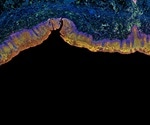 E-FRET Microscopy for Live Cell Imaging