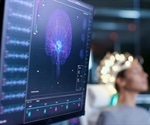 Device converts brain signals into speech, offering hope for patients