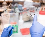 Background Noise in Western Blots