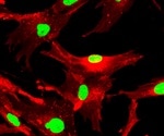 What are Stromal Cells (Mesenchymal Stem Cells)?