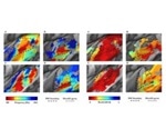 Study investigates how early blindness shapes sound processing