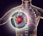 Cancer vaccine injected into tumour could kill all cancer cells