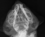 Developing a Micro-CT Scanner for Preclinical Imaging