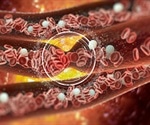 What Are Rare Clotting Factor Deficiencies?