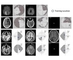 Brain stimulation accelerates visual learning and recovery